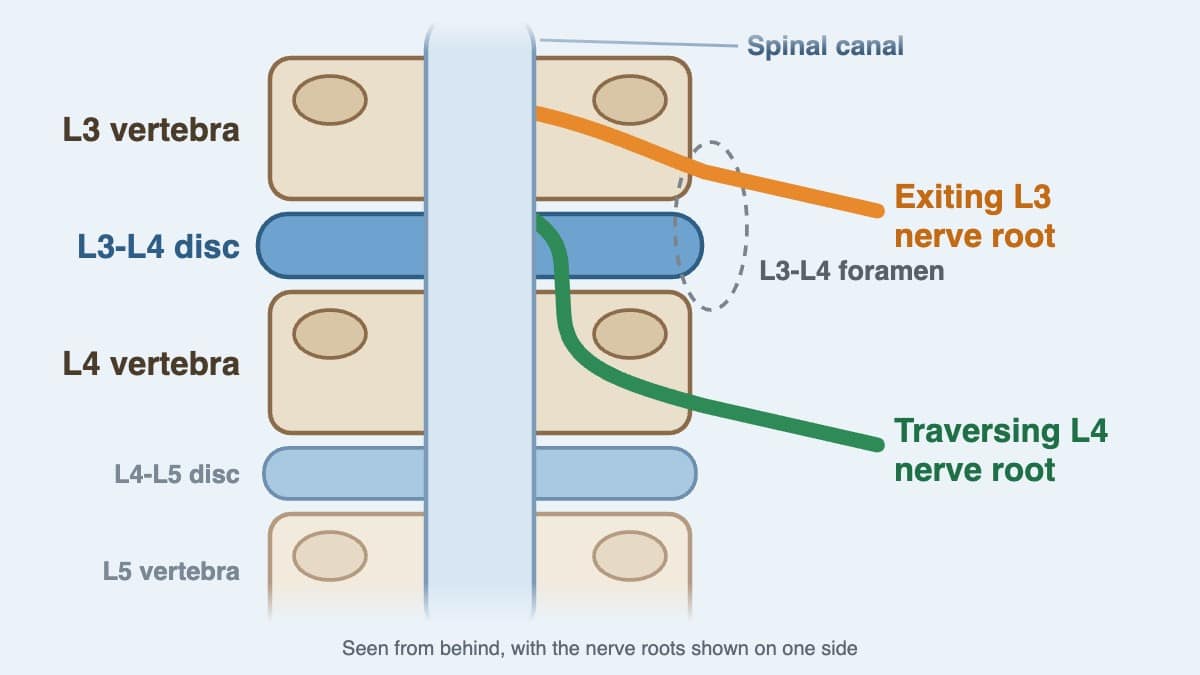 You are currently viewing L3-L4 Spine: Location, Meaning, Nerves and Disc Bulge