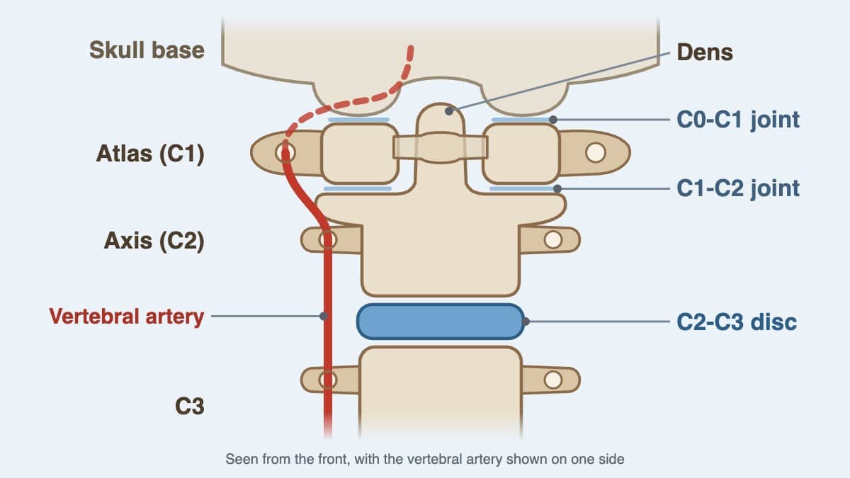 Read more about the article Upper Cervical Chiropractor KL: Non-Force Atlas Adjustment