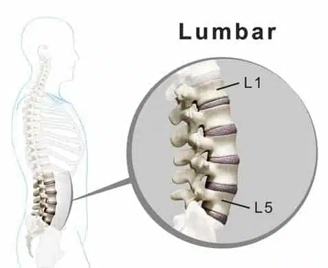 Side view of the human spine with the lumbar section magnified, showing the L1 to L5 vertebrae and, below L5, the L5-S1 disc resting on the sacrum
