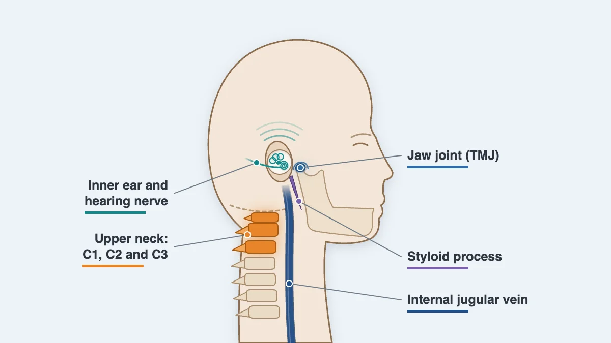 Labeled drawing of the parts linked to ear ringing: the inner ear and hearing nerve, the jaw joint, the styloid process below the ear, the internal jugular vein passing between the styloid and C1, and the upper neck from C1 to C3
